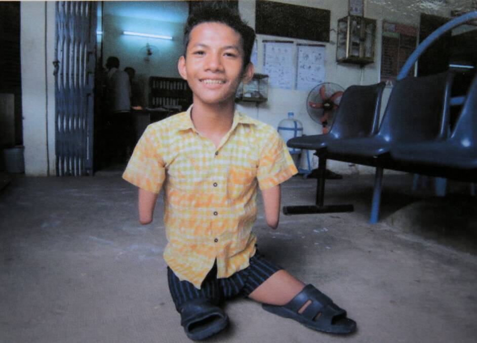 Toy Sok Dong has received artificial legs form the Cambodia Trust.