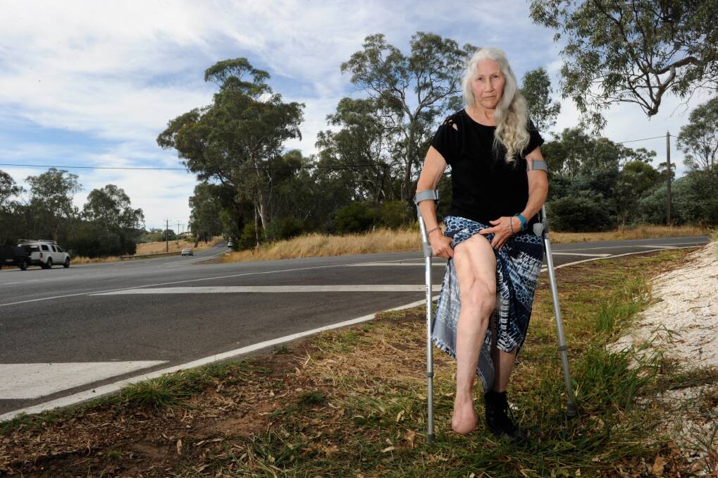 Evelyn Satterly shows the injuries to her leg following the crash.  Picture: NONI HYETT