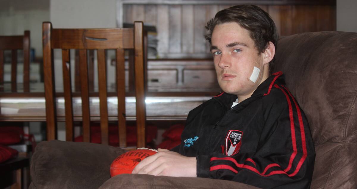 HURT: Koroit footballer Darcy Keane broke his jaw in a Hampden league under 16 game. The Saints have asked for the incident to be investigated. Picture: Justine McCullagh-Beasy