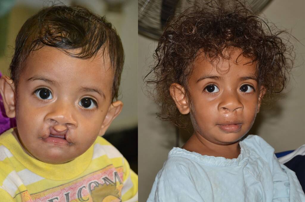 Before and after: One of the patients that received treatment from Dr Ian Holten. 