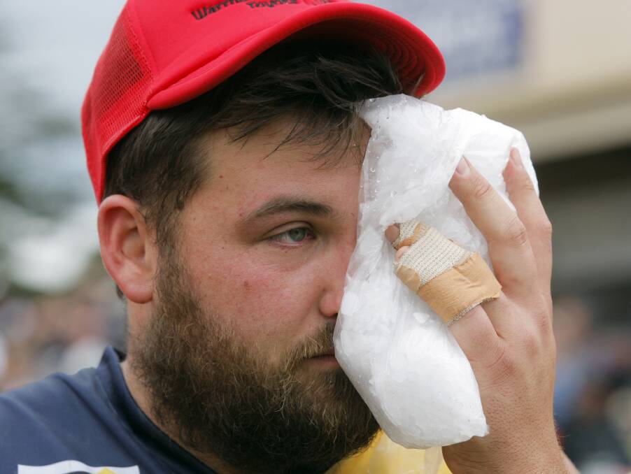 OUCH: North Warrnambool Eagles forward Nick Butters ices his injured eye after copping a knee to the face in a scuffle off the ball.