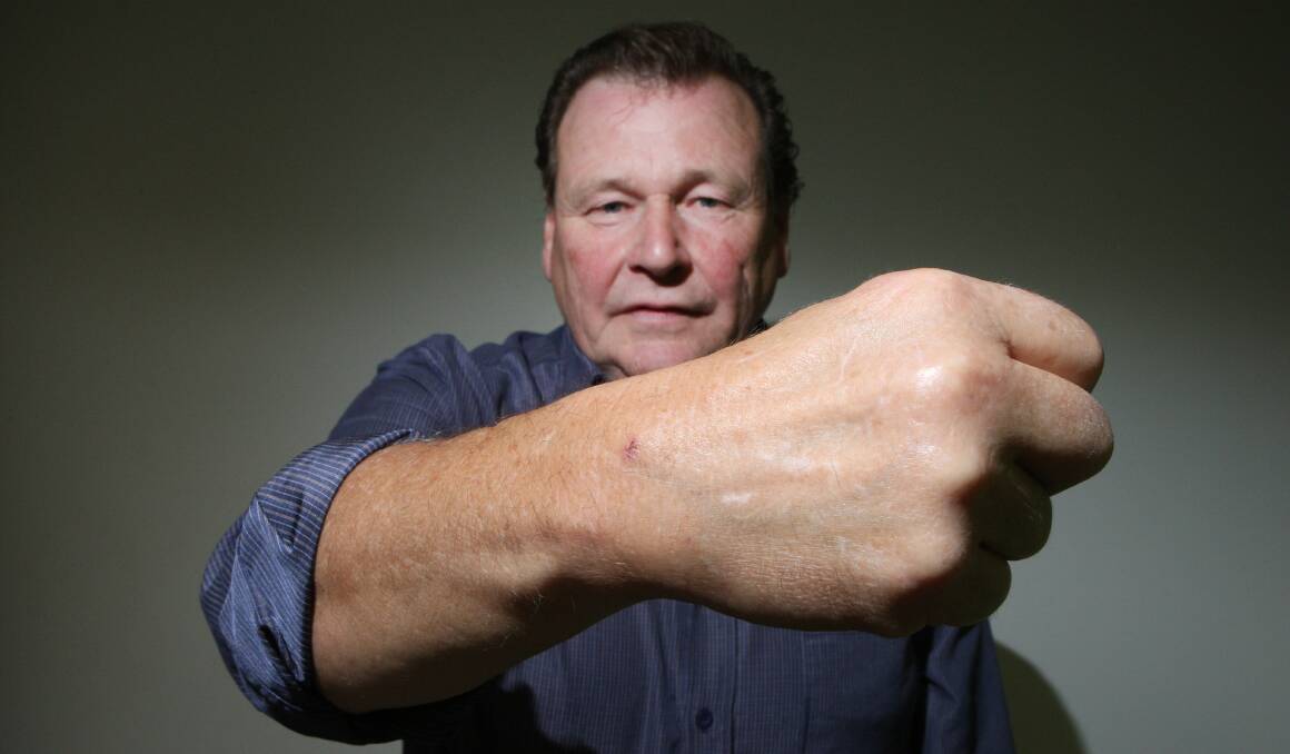 While trying to free a flying fox caught in netting around his trees, Bushfield resident Bill Morris received a scratch to his arm from the animal, requiring a trip to Geelong hospital for a vaccine shot.  