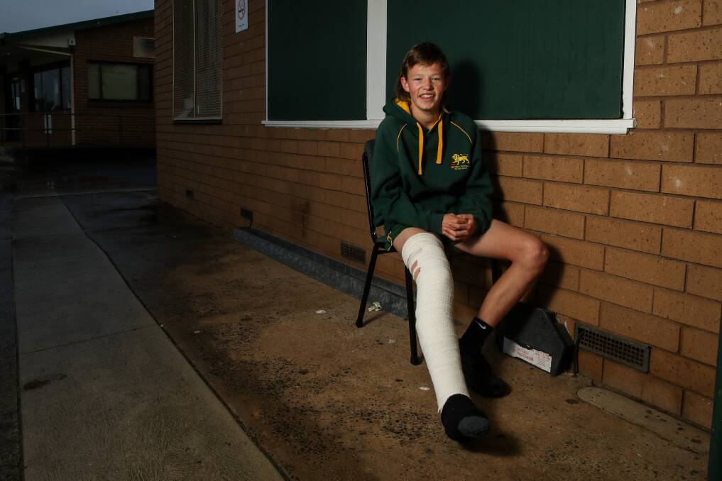 ON THE MEND: Owen Anderson will miss the rest of the football season. Picture: Morgan Hancock