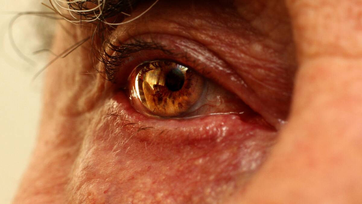 Macular degeneration affects many Australians over 50 years old. Picture by Jonathon Carroll