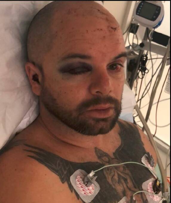AFTERMATH: Danny Chatfield in his hospital bed at the Royal Melbourne Hospital. He suffered two skull fractures and bleeding on the brain. 