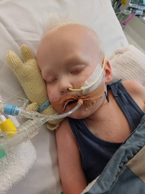 Hugo Riedl, 3, spent a week in the intensive care unit at the Royal Children's Hospital. Picture supplied