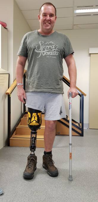 Recovery: Gary learning to walk with his new prosthetic leg. 