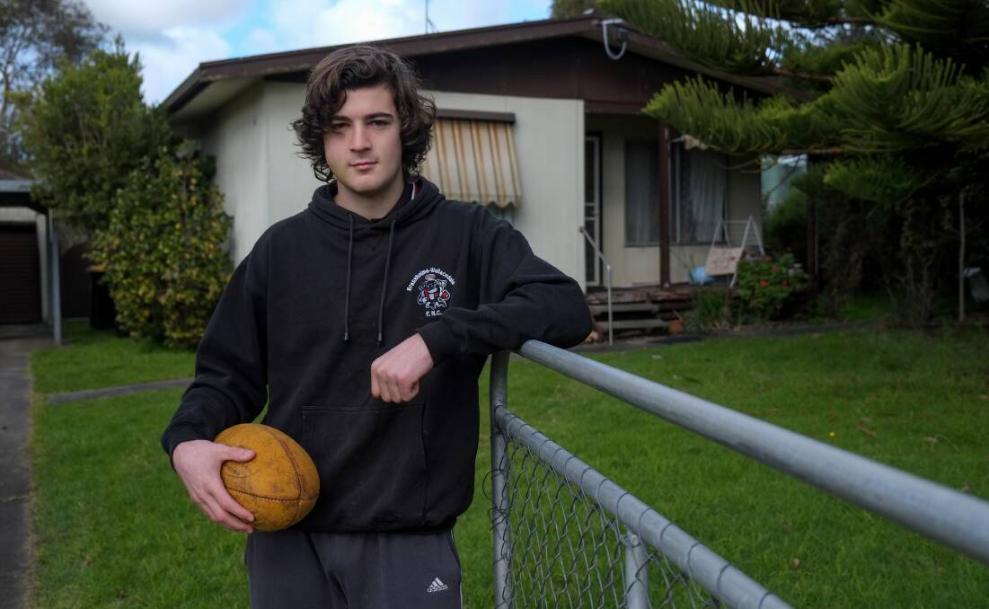 Black and blue: Branxholme-Wallacedale football Sam Lambevski, 17, recovering at home after the incident. Picture: Rob Gunstone