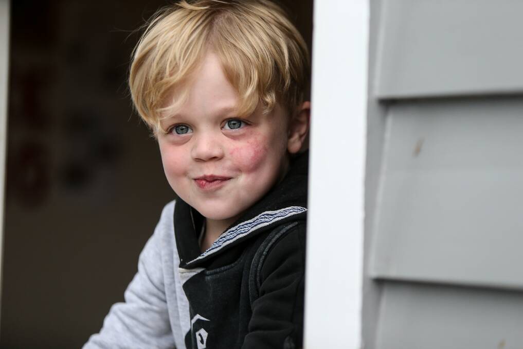 Energetic: Noah Dowie's family hopes to take him to a US medical camp to seek a second opinion from specialists about a rare blood condition he has had for the past three years. Picture: Anthony Brady