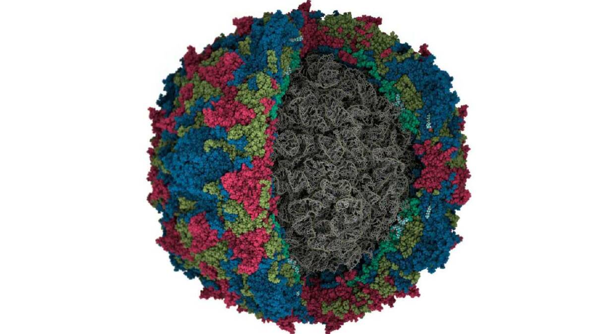 Evidence has emerged of the polio virus returning to the US and UK. Picture by Dr Jason A Roberts, Royal Melbourne Hospital's Victorian Infectious Diseases Reference Laboratory.