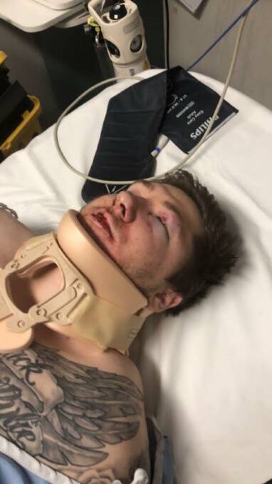 BRUTAL: Warrnambool's Luke Featherby, 20, was seriously injured in an alcohol-fuelled attack that left him unconscious outside a Warrnambool hotel. Picture: Supplied.