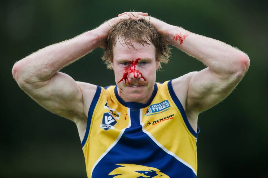 Ouch: North Warrnambool's Adam Wines reacts after coping a hand to the face. Picture: Morgan Hancock