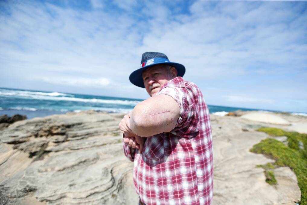 Health warning: Dennington's Neville Dance was shocked that a wart-like growth he had removed from his arm last year turned out to be stage five melanoma. Picture: Anthony Brady