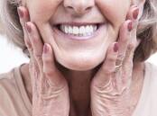 Implants can help transform your smile and health. Picture Shutterstock