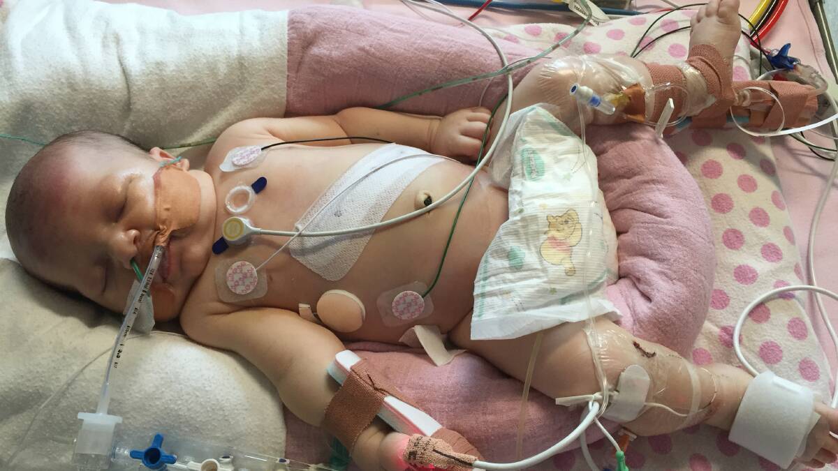 Post surgery: Five-day-old Calla recovers from surgery to repair a hole in her diaphragm. Picture: supplied.