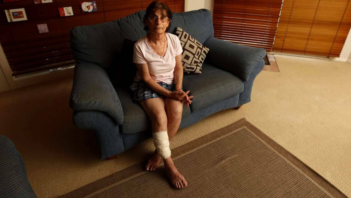 Yolanda Davies at her home after being attacked by a dog, whose owner left the scene without helping her. Photo: JONATHAN CARROLL